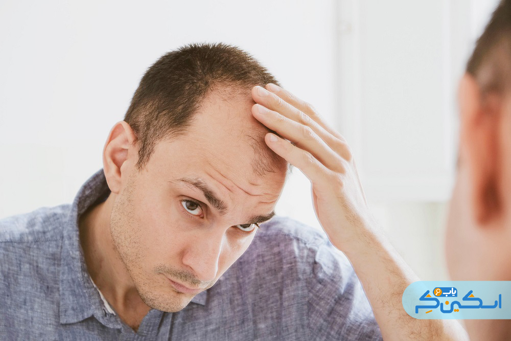 اختلالات فولیکول مو