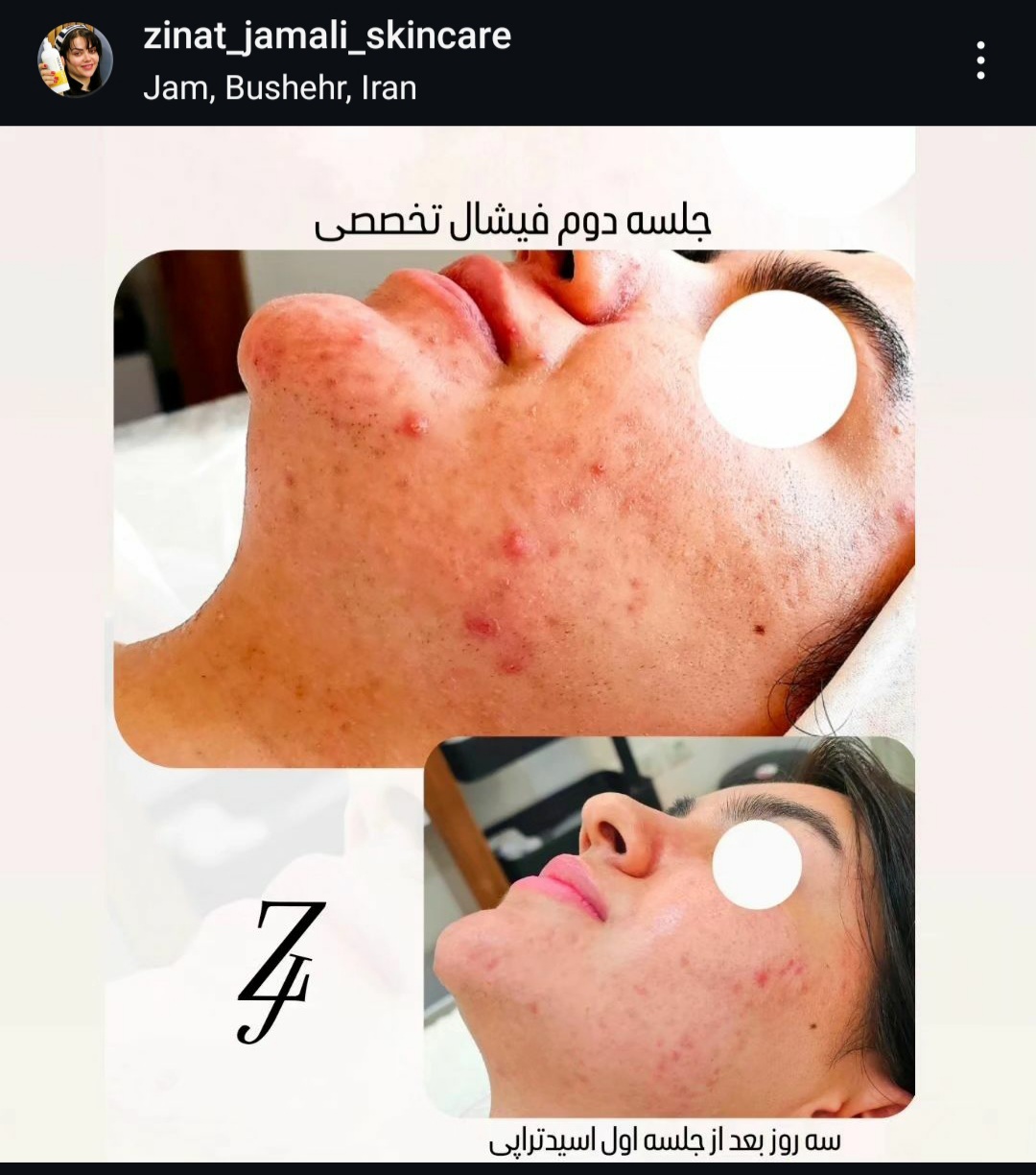 فبل و بعد