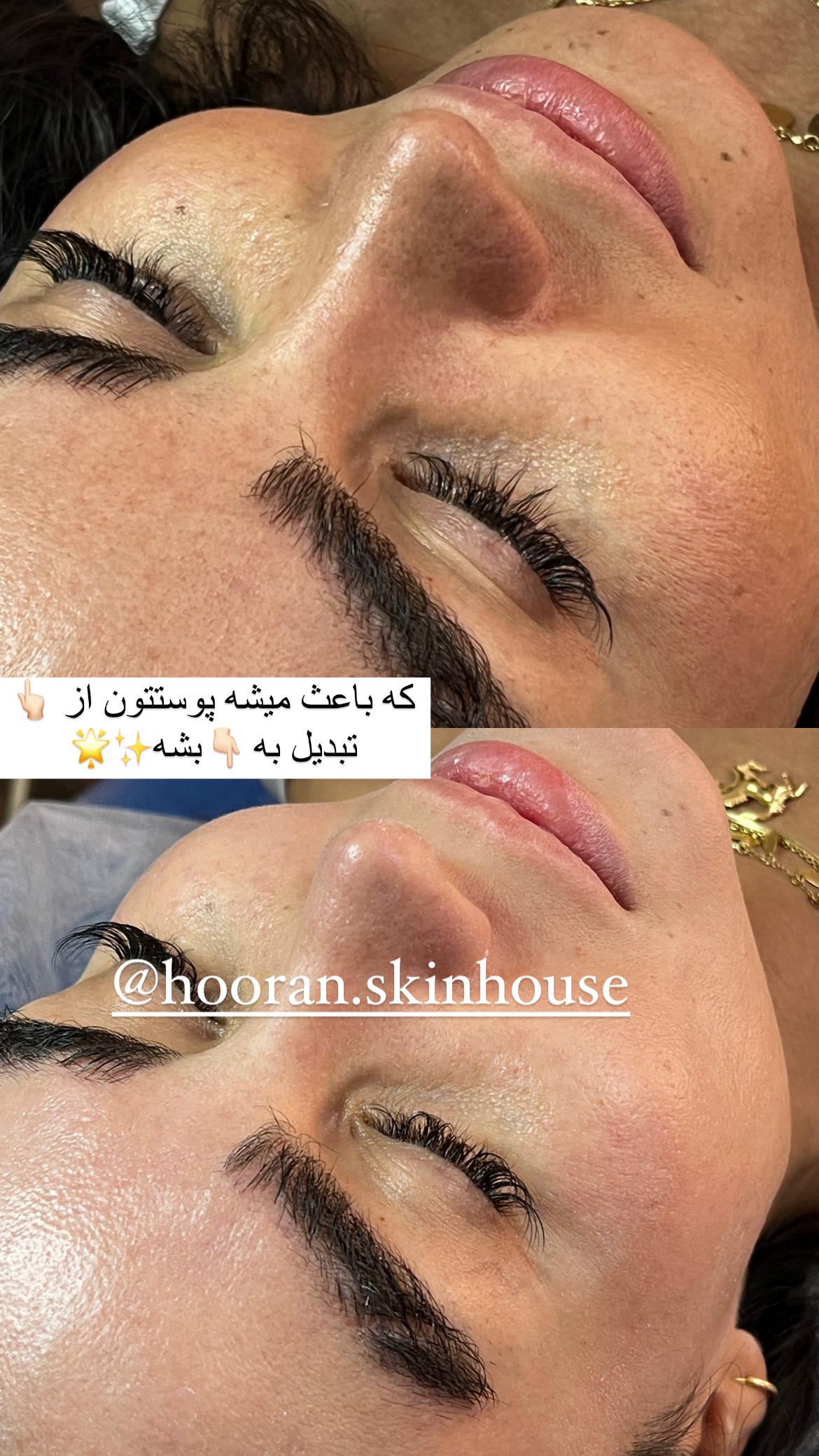 فیشیال