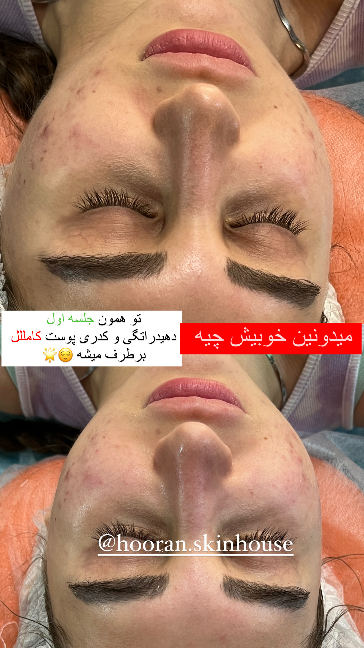 فیشیال
