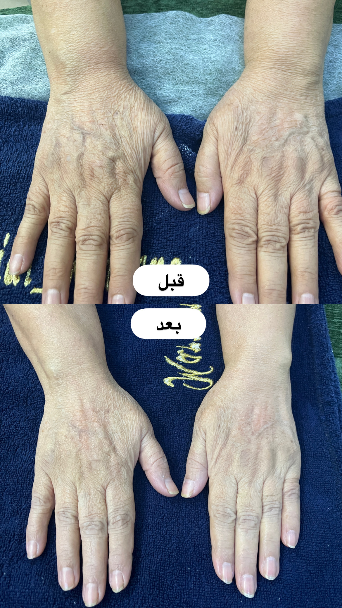 پاکسازی و جوانسازی دست