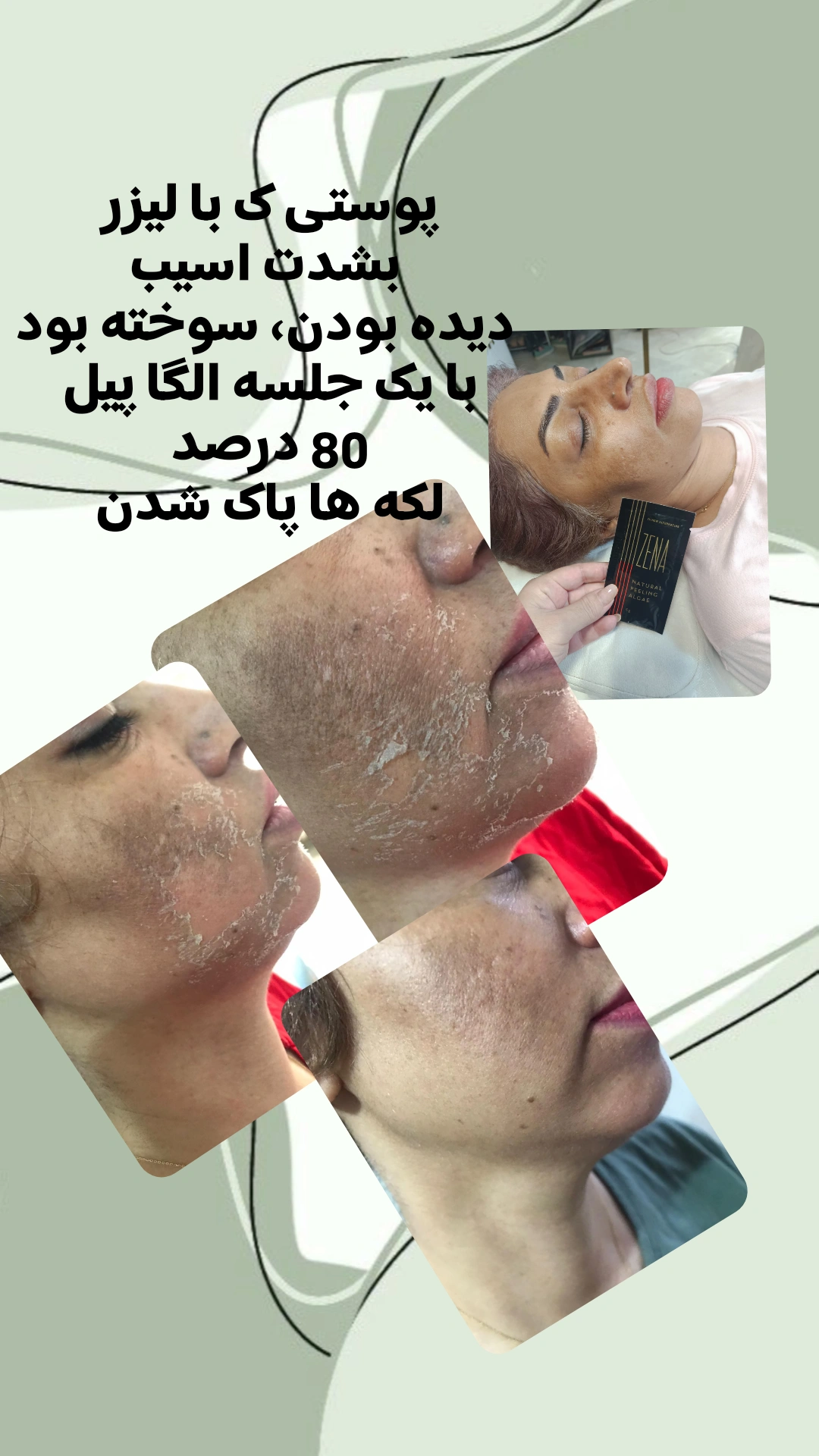 1000472870.webp