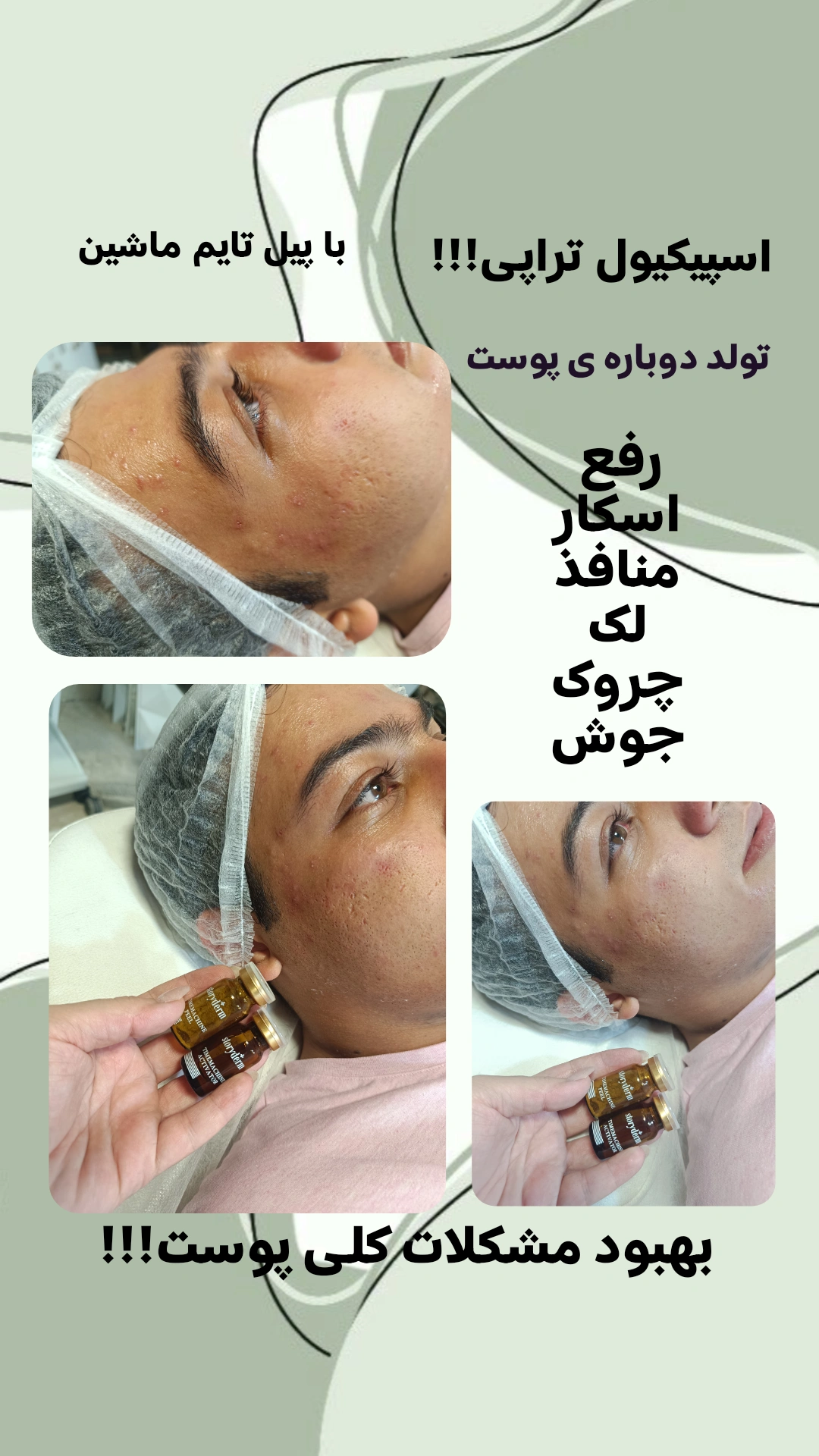 1000472993.webp
