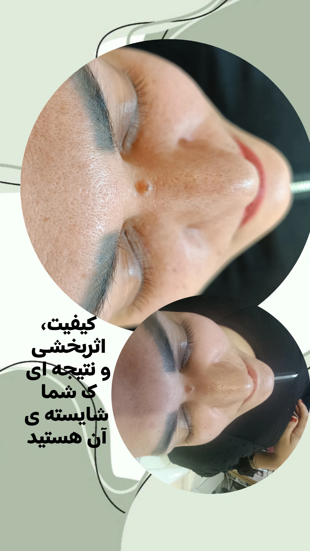 1000472858.webp