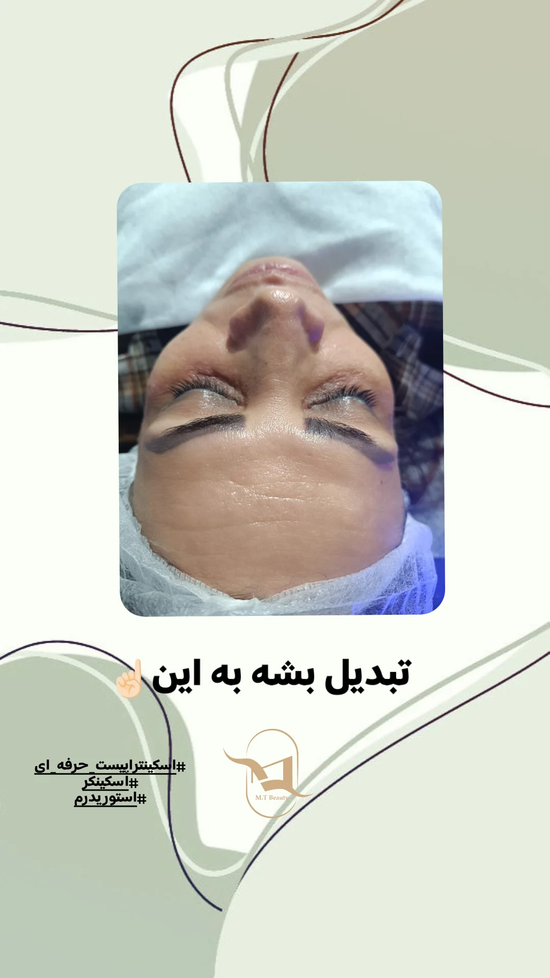 matin_healthskin_14031112_173833788.jpg