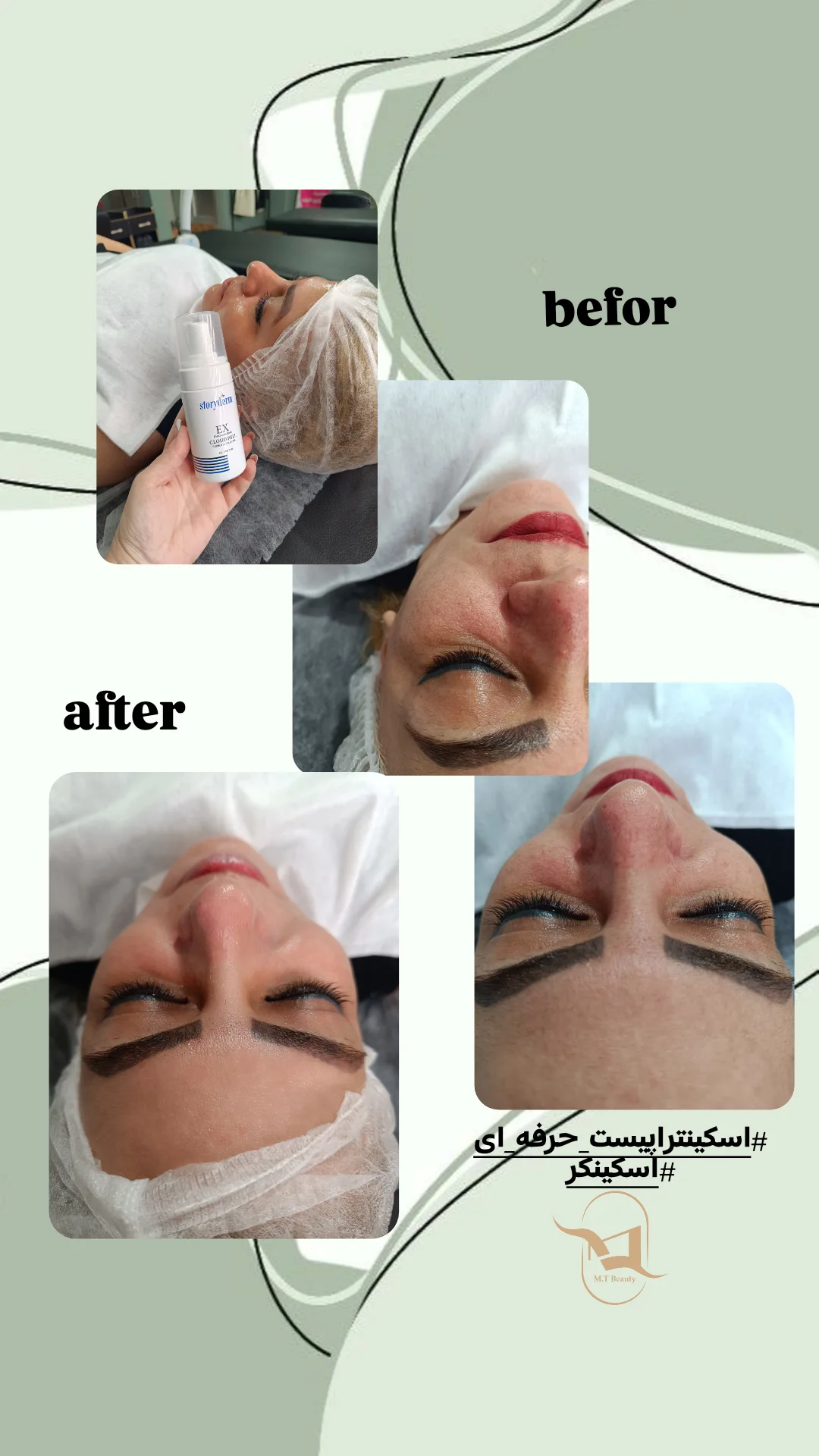 matin_healthskin_14031112_172929497.jpg