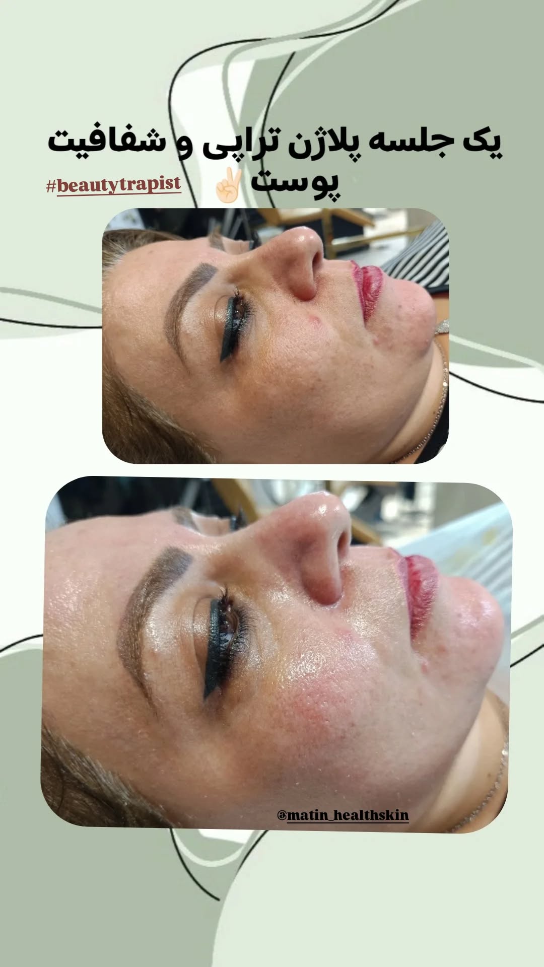 matin_healthskin_14031112_173707580.jpg